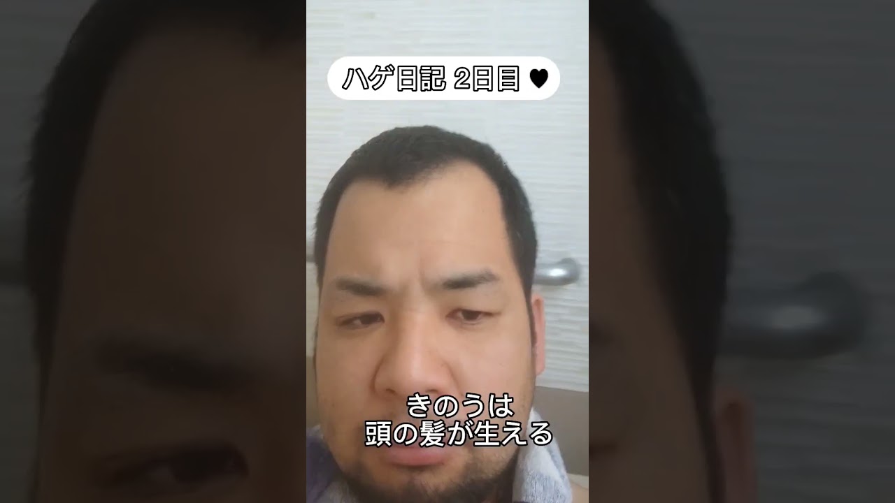 ハゲ日記AGA 植毛をしにトルコにいこうかな。