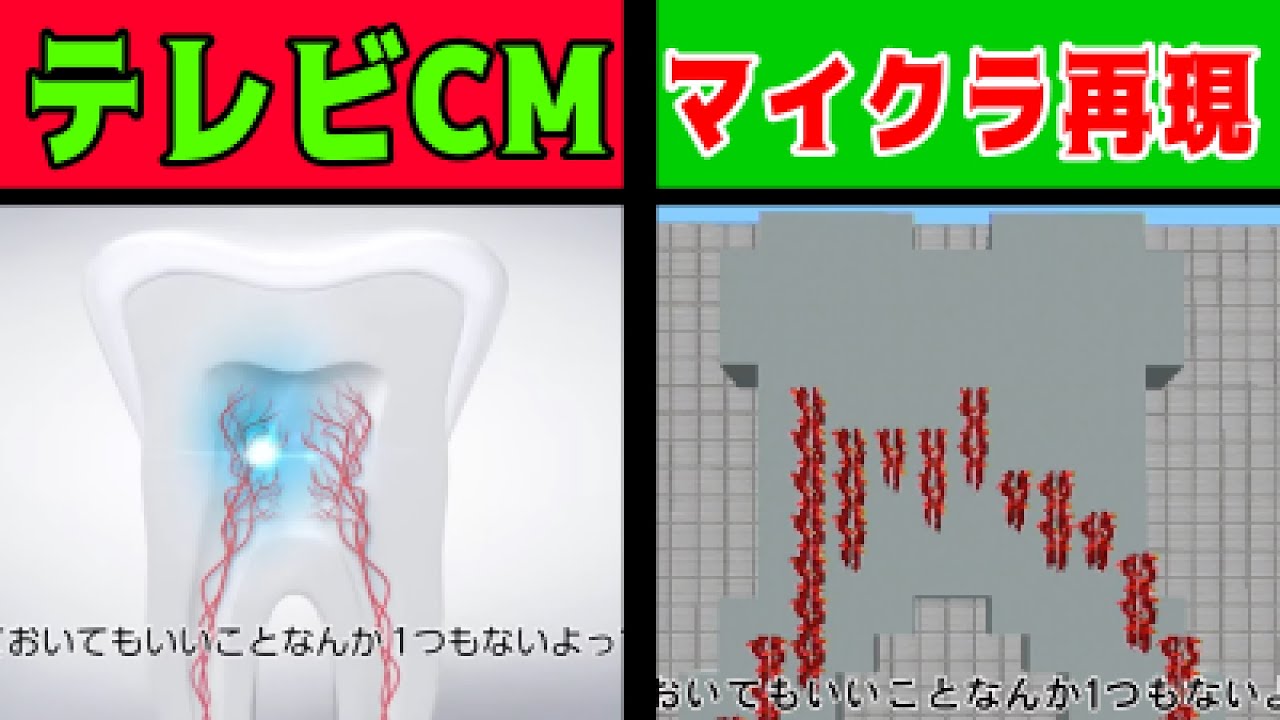 【マイクラ】シュミテクトの歯周病ケア再現