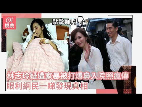 林志玲疑被打爆鼻入院照瘋傳　眼利網民一睇發現真相｜01娛樂｜林志玲｜黑澤良平