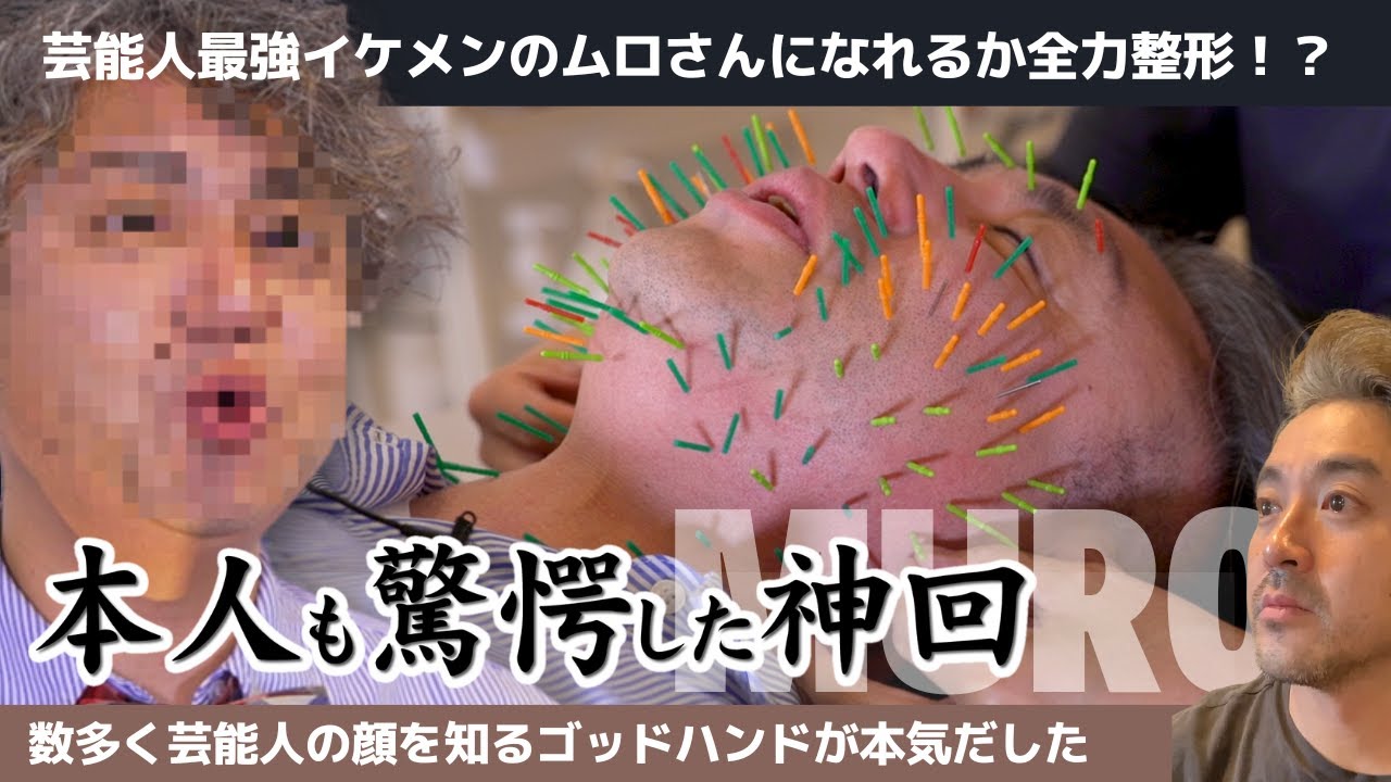 【本人も驚愕】私をムロ様にしてください！数多くの芸能人を施術した天才に懇願！ 角森脩平 先生（東京｜代官山）