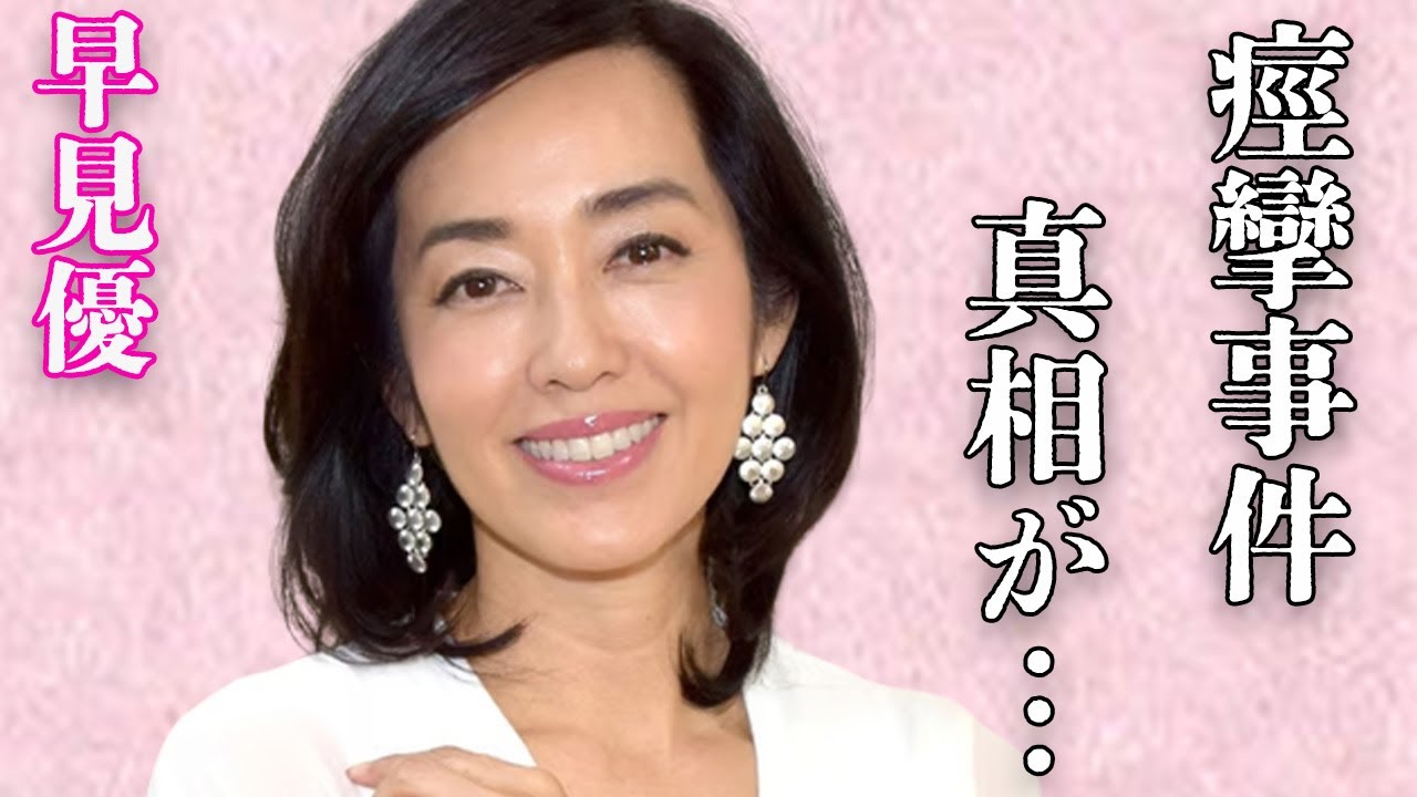 早見優の“難病”の現在の病状や舘ひろしとの“痙攣事件”の真相に言葉を失う…「夏色のナンシー」でも有名な歌手が夫・福田富雄との離婚の危機に陥った原因に驚きを隠せない…