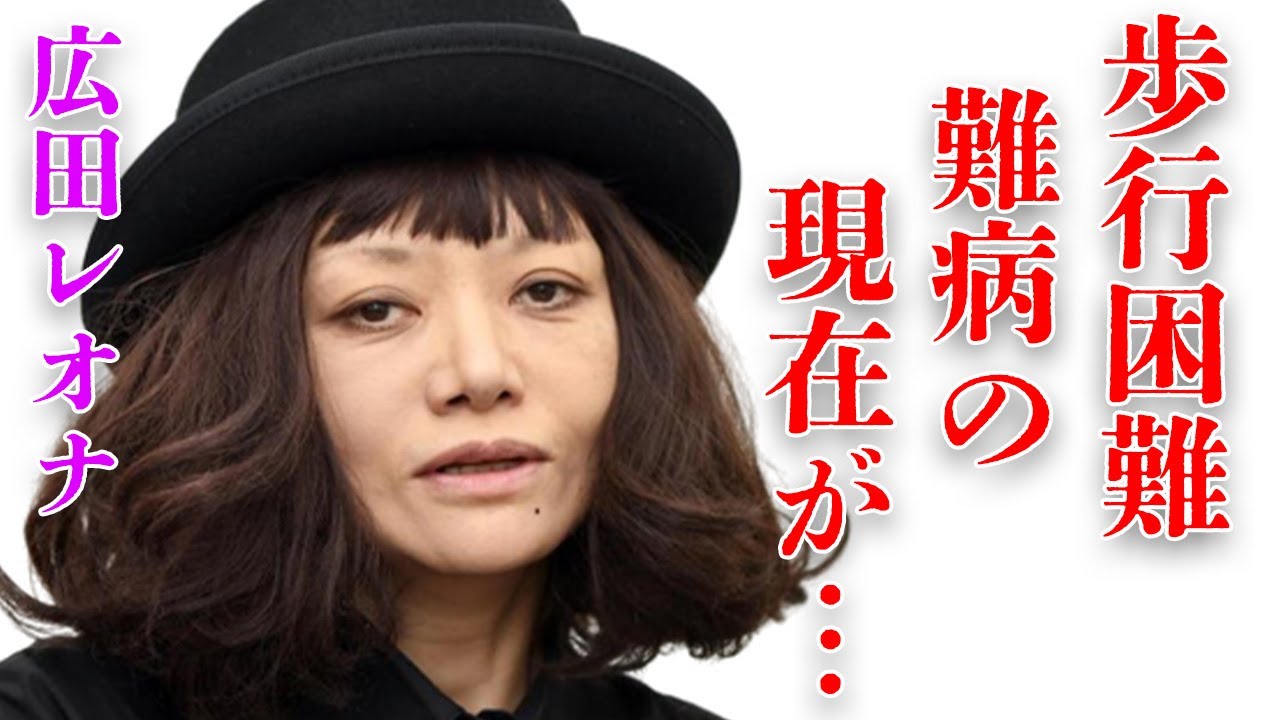 広田レオナの歩くこともままならない“難病”の現在に言葉を失う…「だいじょうぶマイフレンド」でも有名な女優が惑わせてきた男性の数々に驚きを隠せない…