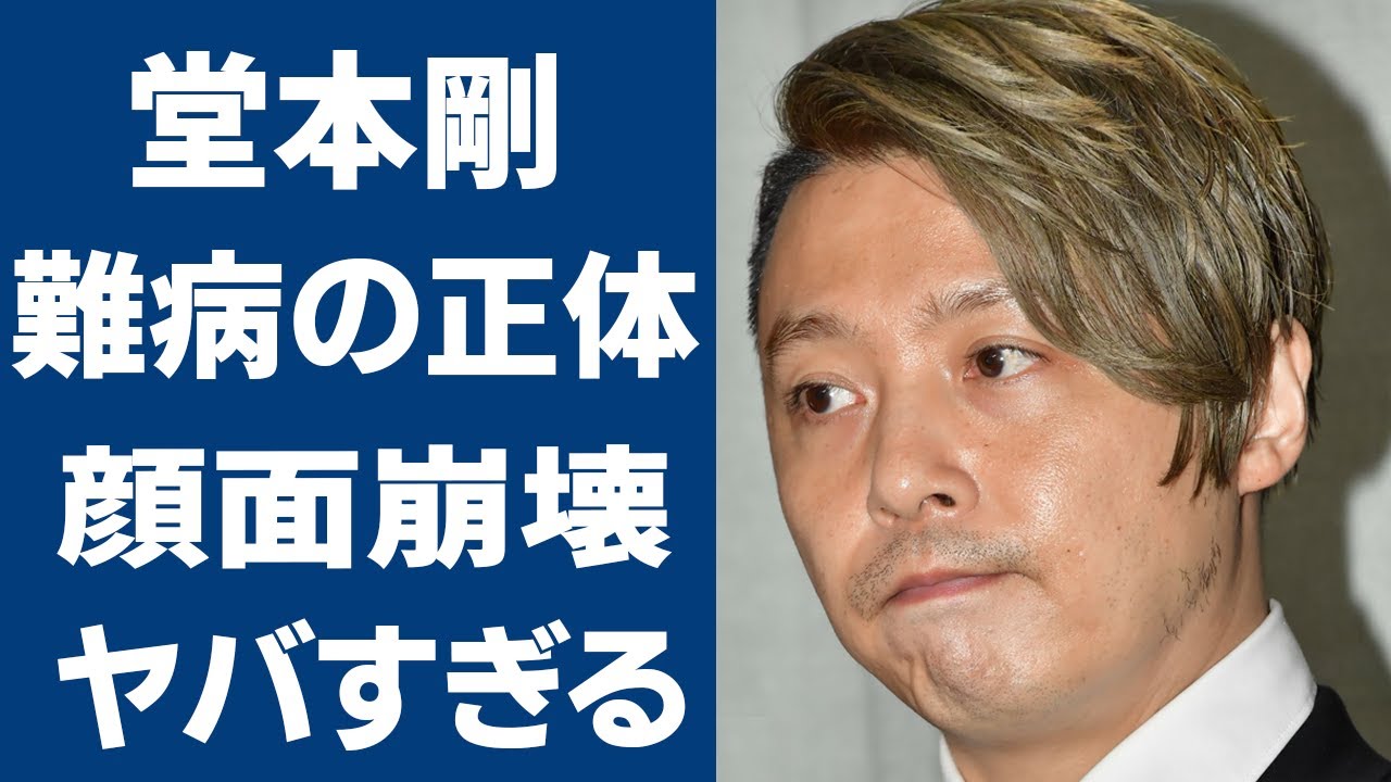 堂本剛の病気が過酷すぎる…顔面崩壊した現在の姿に一同驚愕…！「KinKi Kids」として活躍するアイドルの芸能界引退の噂の真相がヤバすぎ…！
