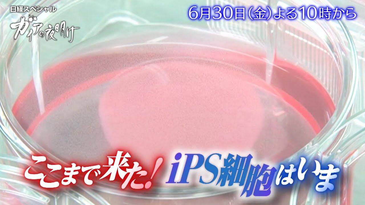 ガイアの夜明け【ここまで来た！iPS細胞はいま】予告