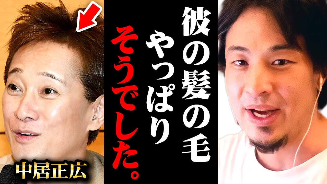 ※元SMAP中居正広が突然のカツラ告白※これがハゲている人の真実です【 切り抜き 2ちゃんねる 思考 論破 kirinuki きりぬき hiroyuki ハゲ ミノキシジル AGA 脱毛症 ウィッグ】