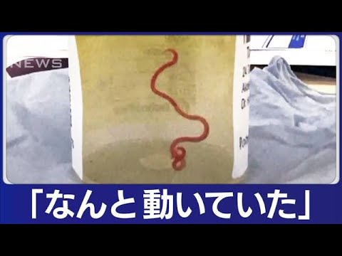 女性の脳から体長8センチの生きた寄生虫　MRI検査で異常発見し摘出(2023年8月30日)
