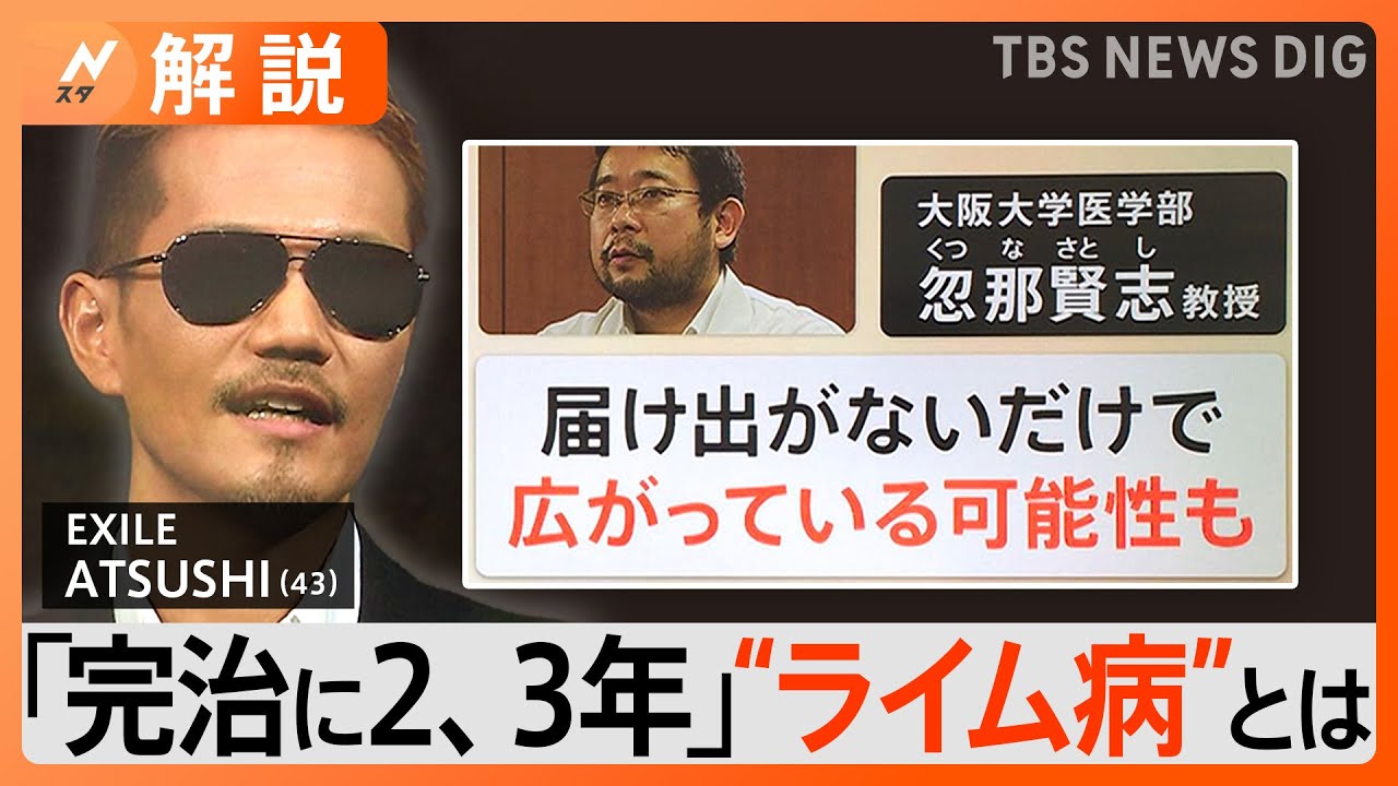 「どん底感…」EXILEのATSUSHIさん公表の“ライム病”とは　鍵を握る“マダニ”【Nスタ解説】｜TBS NEWS DIG