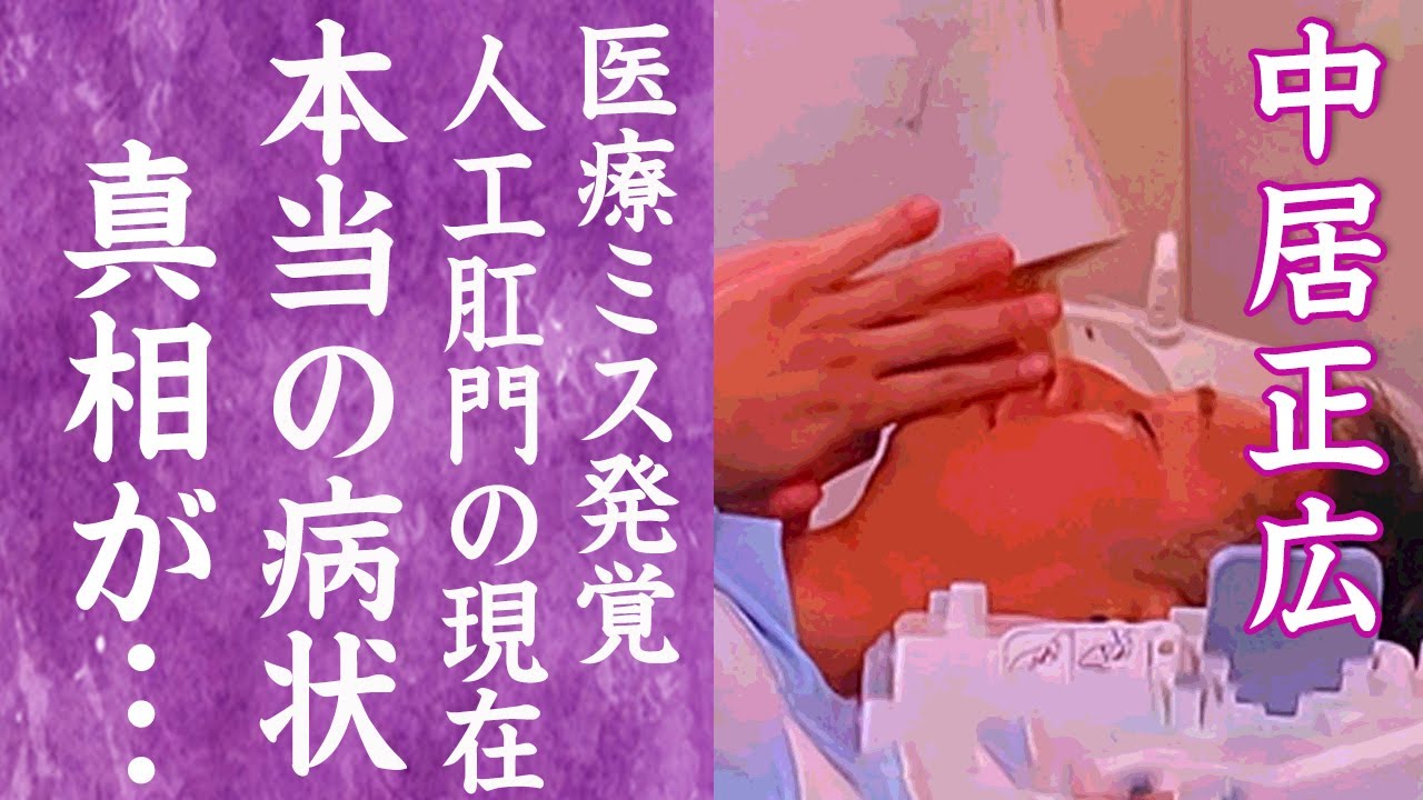 【驚愕】中居正広の暴露された本当の病状…医療ミスで重症化し大腸を切除"人工肛門"になった現在に一同驚愕！『SMAP』元メンバーが激痩せした本当の理由…嘘を語り擁護していた人物の正体に驚きを隠せない…！