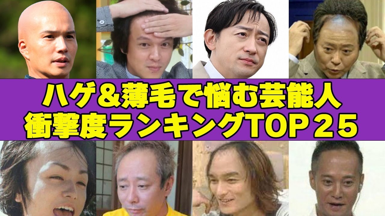 ハゲ＆薄毛で悩む芸能人衝撃度ランキングTOP25！！”劣化”まさかのイケメン俳優やアイドルまで…増毛に成功した人物とは？