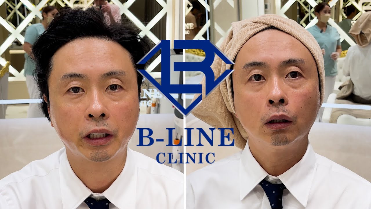 【次長課長河本】お肌ツルツル王子！大阪へ行く！の巻。1回で、ほうれい線解消！凄過ぎん？！！