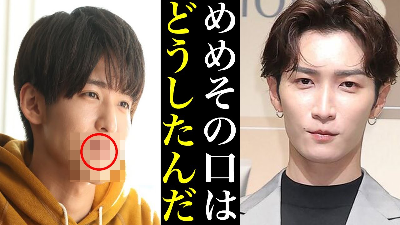 目黒蓮の口元にある変化が...めめ担心配で SnowManはどうなるのか