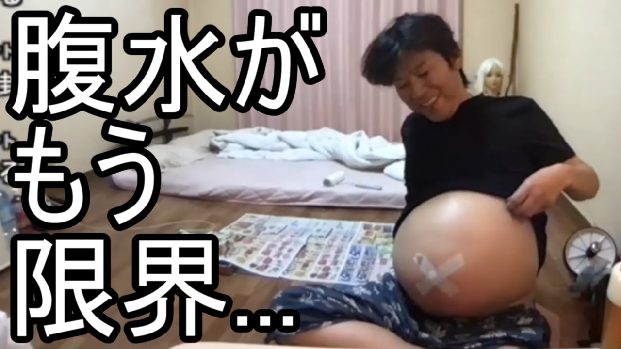 【金バエ】悲報 腹水が限界を超えている事を語る【肝不全 余命1年】 2024/01/12