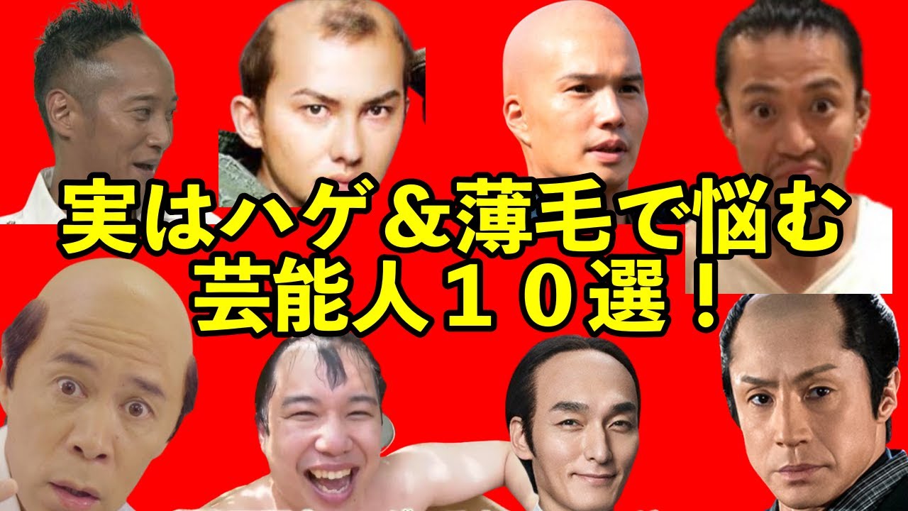 実はハゲ＆薄毛で悩む芸能人１０選！衝撃の10人とは…まさかのイケメン俳優やアイドルまで…