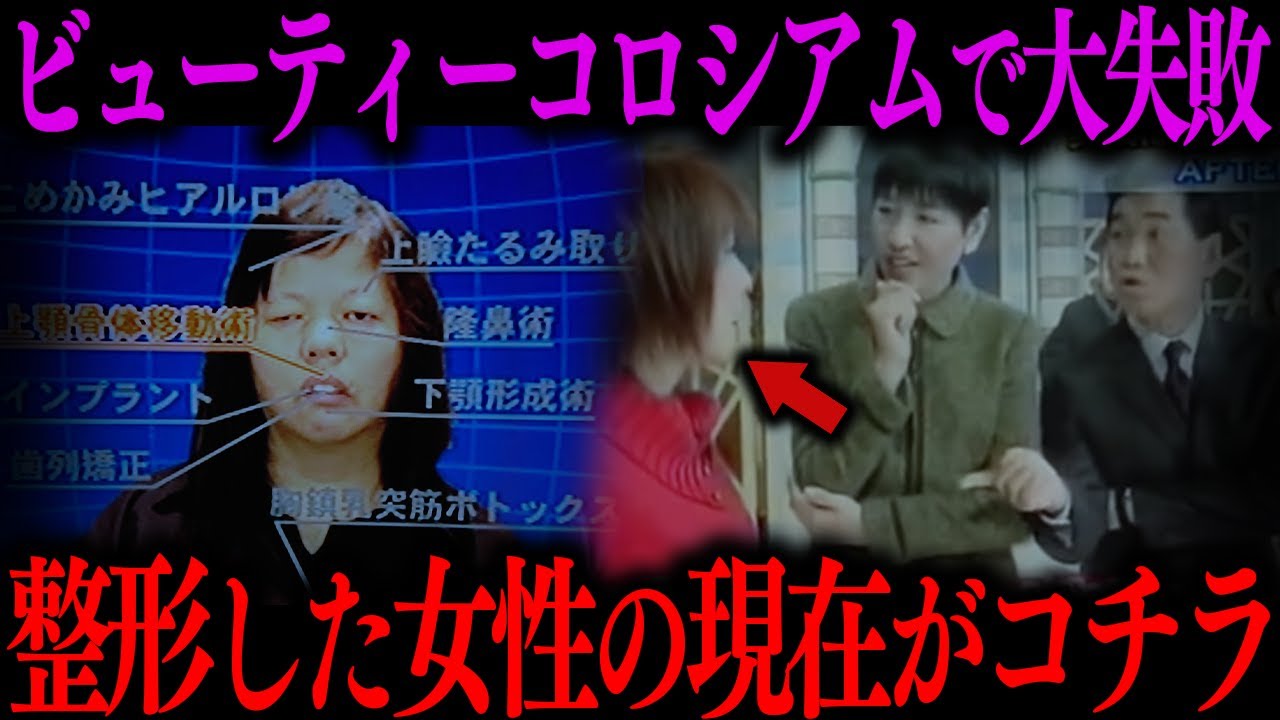 「ビューティーコロシアム」で整形した女性の現在…