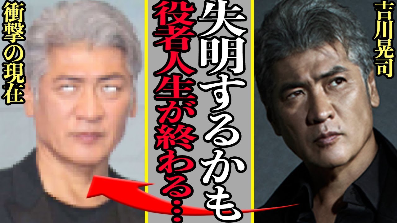 吉川晃司が失明危機で役者廃業の危機に言葉を失う…両目手術でアクション封印、名俳優がドクターストップがかかった原因、医師からの宣告に絶句【芸能】