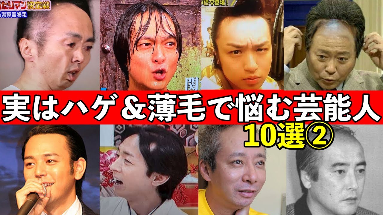 実はハゲ＆薄毛で悩む芸能人10選②衝撃の10人とは…まさかのイケメン俳優やアイドルまで…