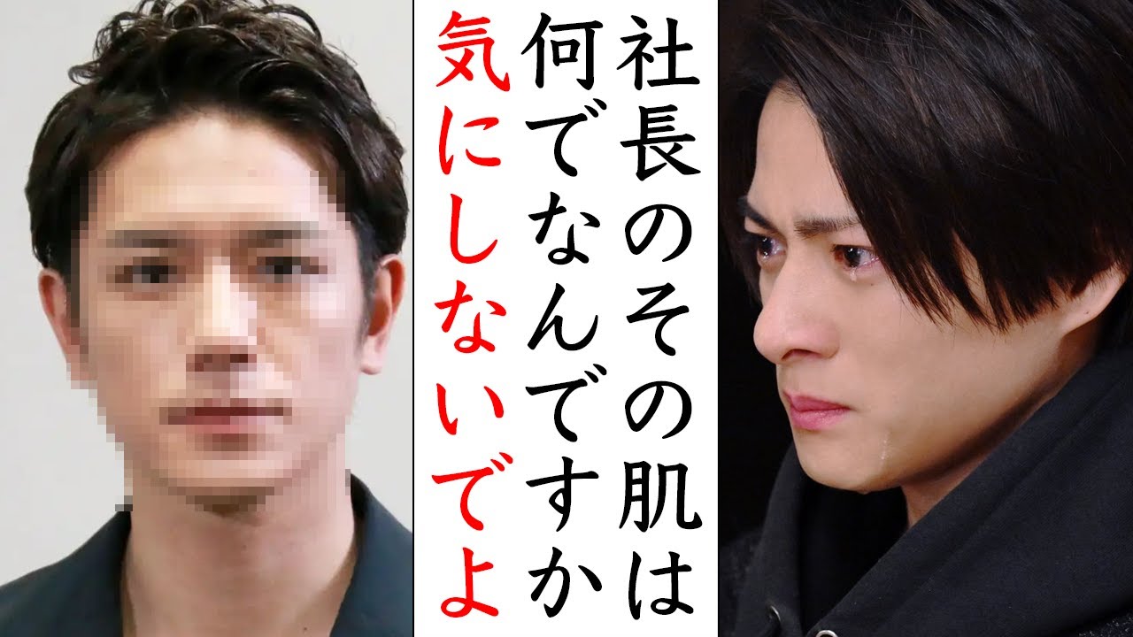 TOBE担心配...滝沢秀明が現在の肌がヤバすぎる...