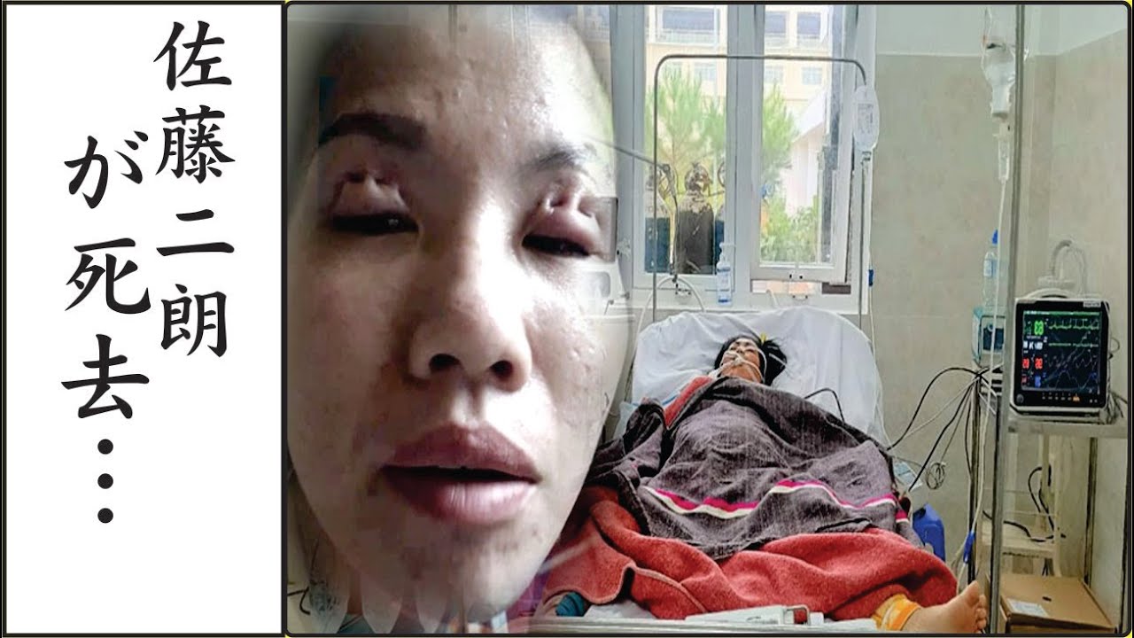 佐藤二朗の娘がガン闘病中と言われる現在や整形で顔面崩壊の真相に一同驚愕…