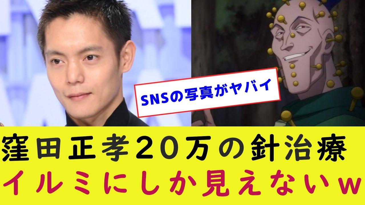 窪田正孝の針治療がイルミにしか見えないwww『30分20万円の鍼治療』著名人が通うルート治療とは？【芸能/鍼治療/ハンターハンター】