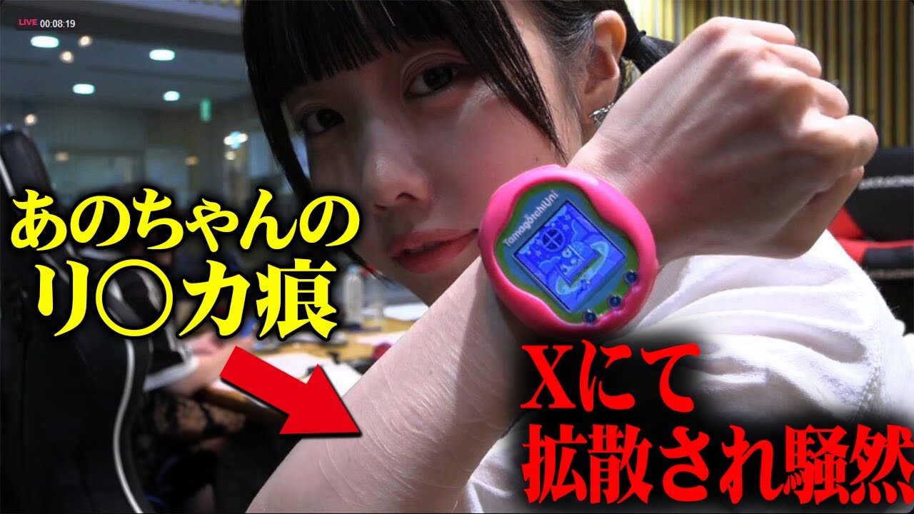 あのちゃんの腕に大量のリ○カ痕が拡散された件について。#あのちゃん　#粗品