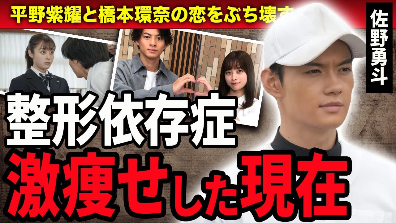 【衝撃】佐野勇斗が平野紫耀と橋本環奈の恋をぶち壊した理由…整形依存に陥り激痩せした現在に驚きが隠せない！『おむすび』でイケメン枠を演じた俳優の熱愛彼女の正体に驚愕！