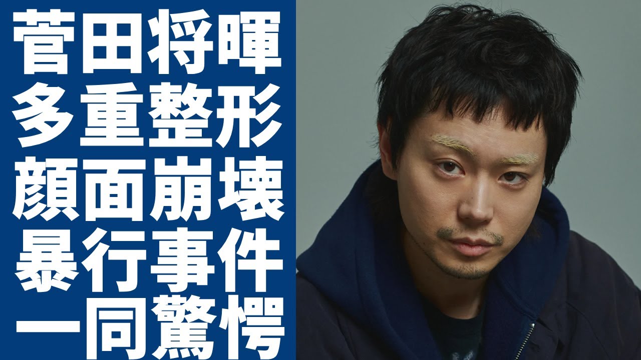 菅田将暉が突然にブサイクになった理由...顔面崩壊と言われる多重整形の真相に一同驚愕...！「日本を代表する」演技は俳優となった彼の暴行事件の真相...大物家族の正体に言葉を失う...