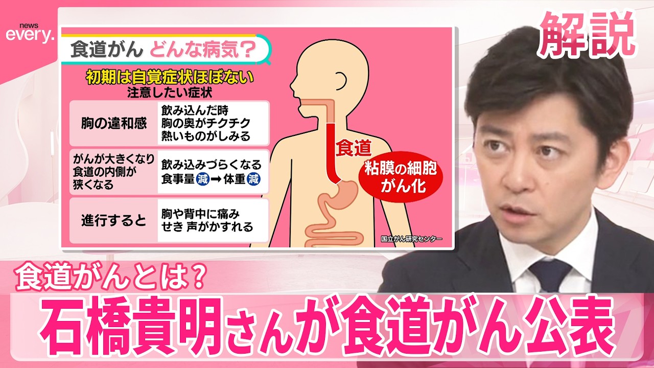 【食道がんとは？】石橋貴明さんが公表  初期は自覚症状がないことがほとんど【#みんなのギモン】