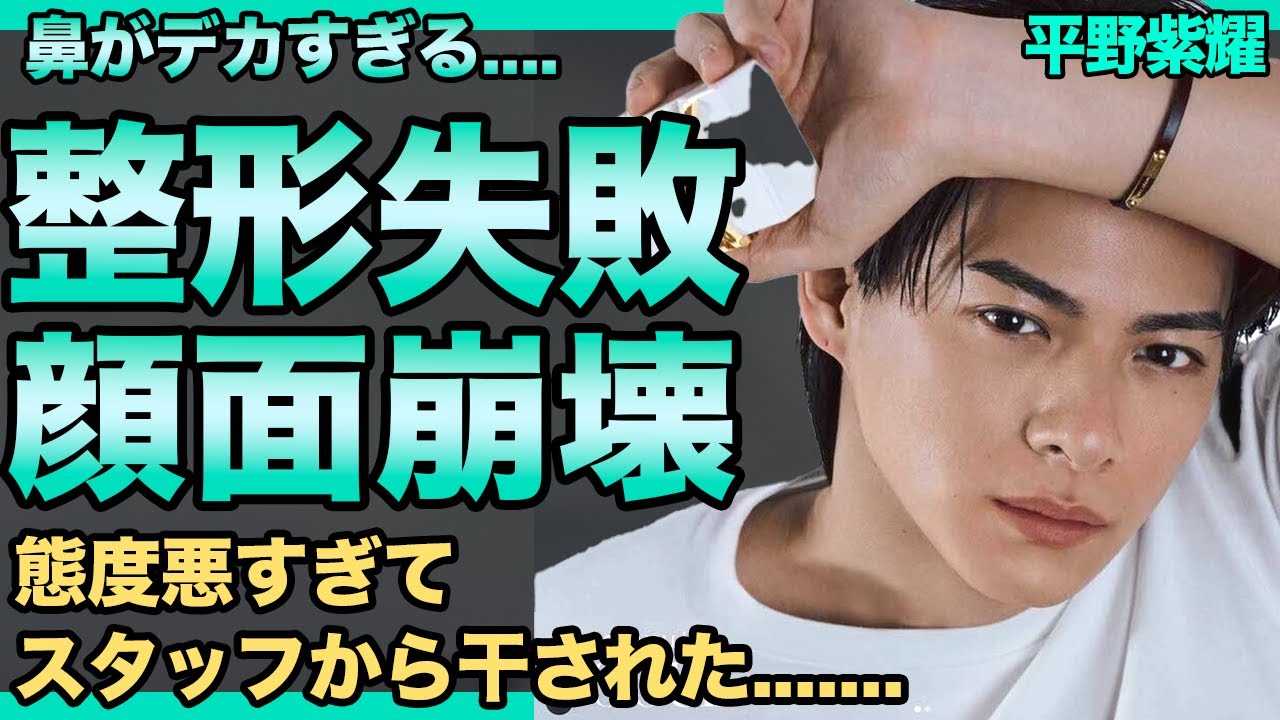 平野紫耀の顔面崩壊した現在...整形失敗し肥大した鼻がヤバすぎる...ビジュ悪くなり人気急落し完全終了...態度悪すぎてスタッフから嫌われ干された真相...彼女の正体に驚きを隠せない！