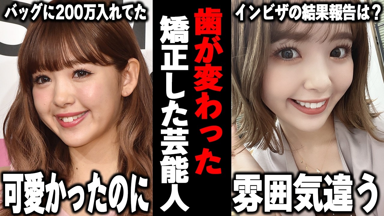 【ガルちゃん芸能】この人もセラミック…！？いつのまにか歯が変わっていた芸能人まとめ！
