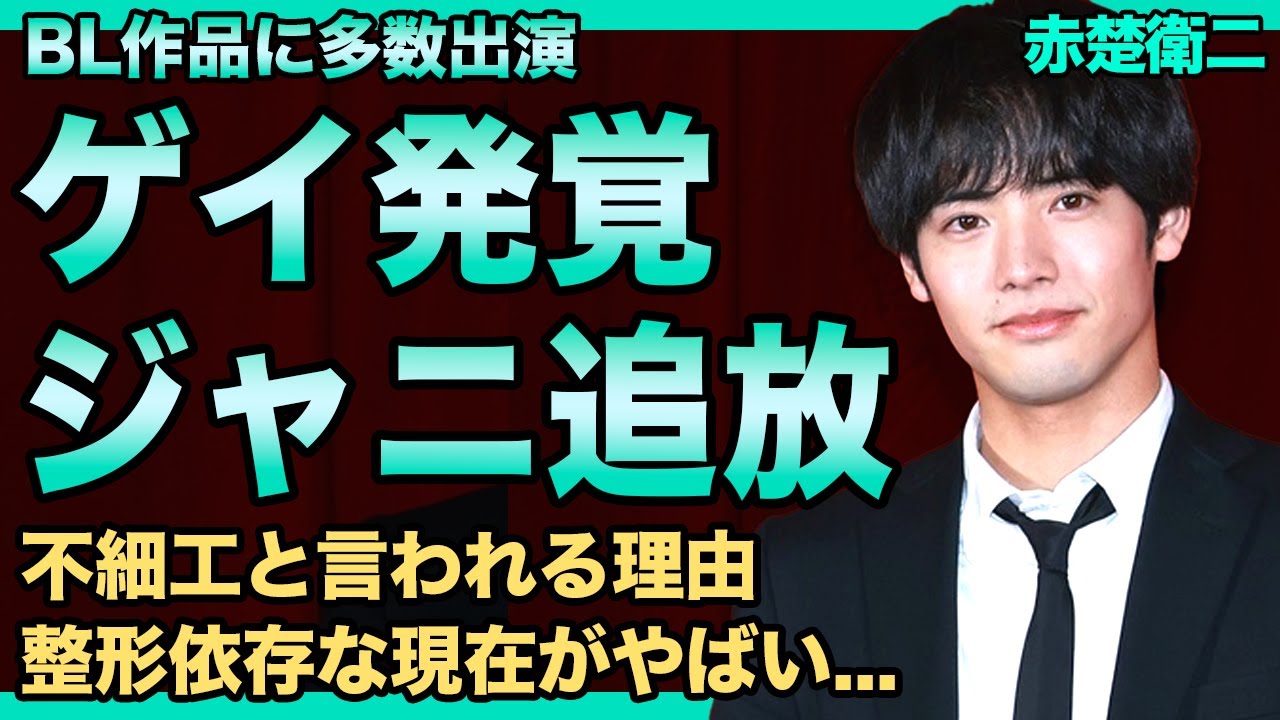 赤楚衛二が同性愛者だと公表していた真相…ジャニーズから追放されたアイドルが抱える難病に驚きを隠せない！『仮面ライダービルド』で話題になった若手俳優が不細工だと言われる実態…整形依存の末路に言葉を失う！
