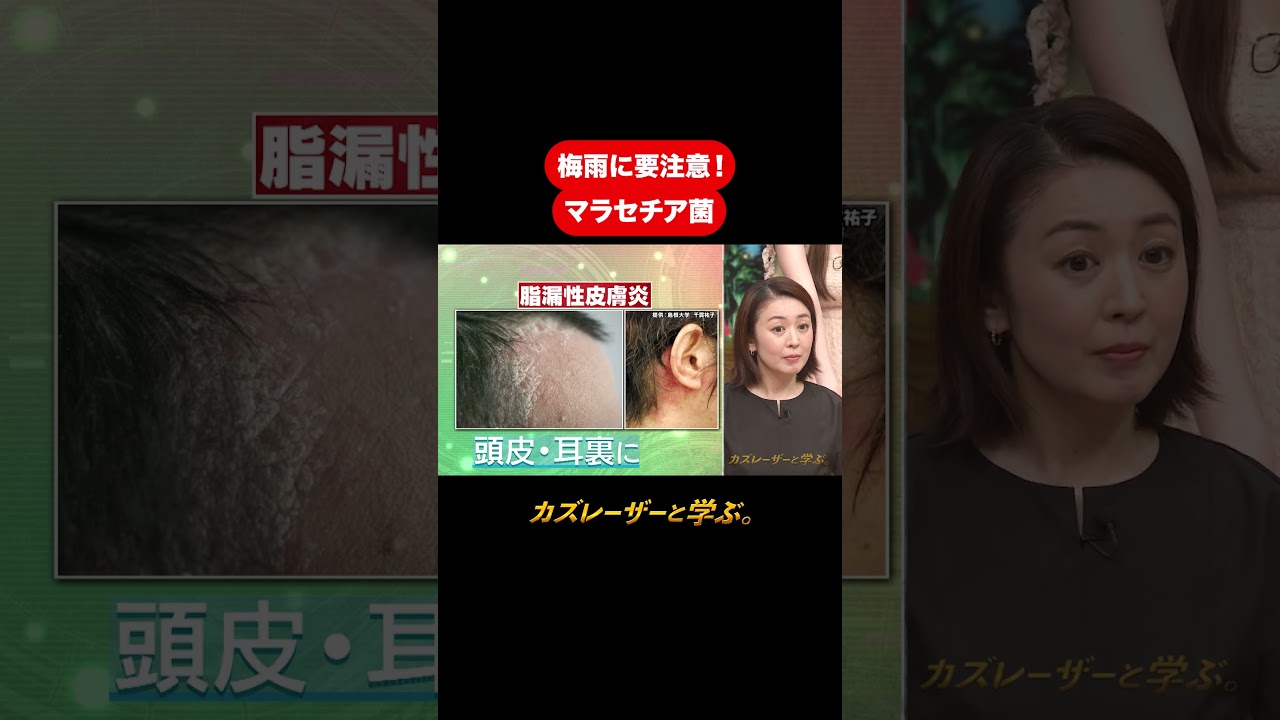 『カズレーザーと学ぶ。』【梅雨に要注意！マラセチア菌】毎週火曜よる10時から放送中！#カズレーザーと学ぶ。#カズレーザー#切り抜き#shorts