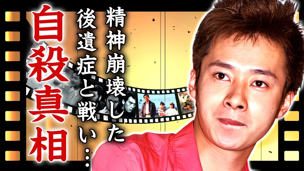 いしだ壱成が自ら命を絶った真相...精神崩壊した逮捕劇の後遺症に涙が止まらない...『石田純一の長男』が髪の毛復活の為にかけた総額...海外で行った手術の全貌がヤバすぎた...