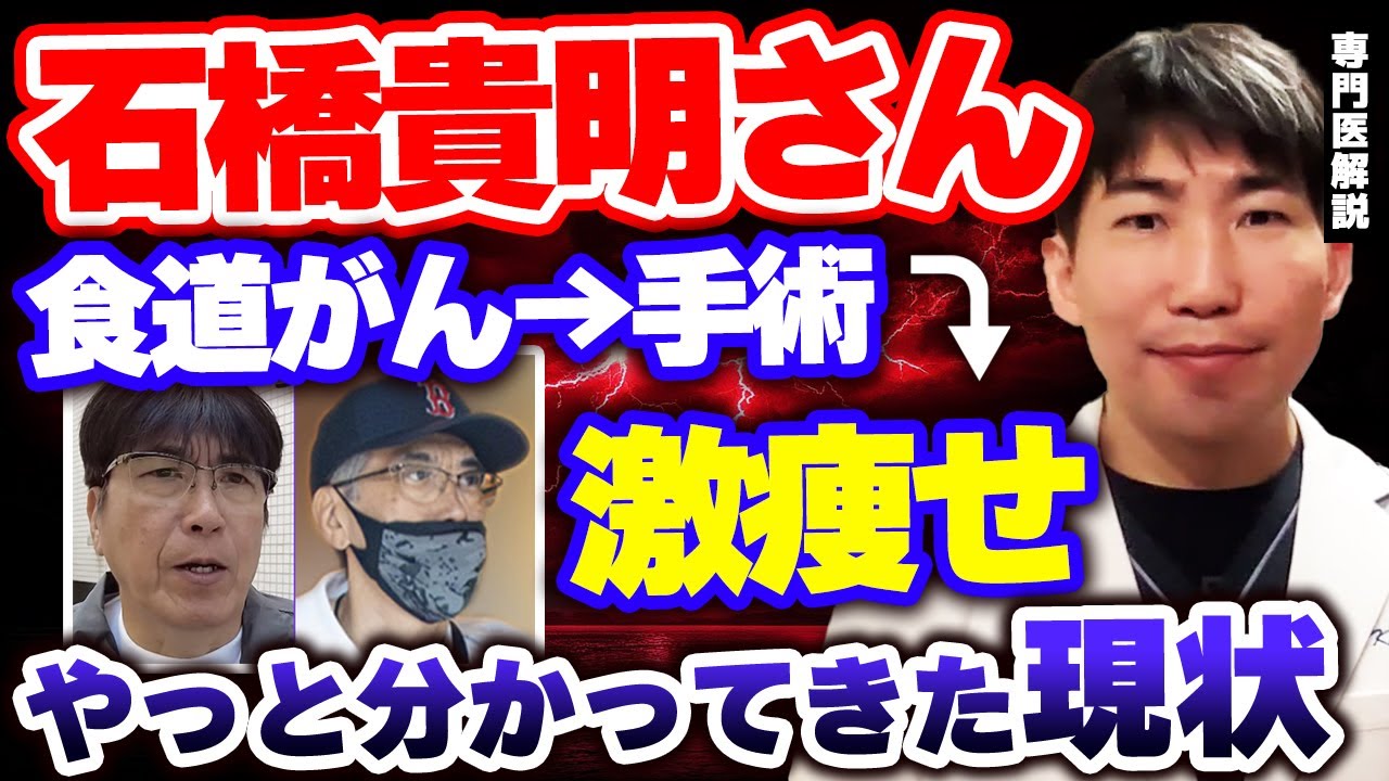 【石橋貴明】食道がん手術後に抗がん剤拒否や激痩せ報道の中、分かってきた現状について現役医師が解説します　有名人がん【消化器専門医】