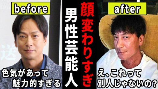 え、もしかして整形した…？昔と顔が変わりすぎな男性芸能人【ガルちゃん芸能・有益2ch】