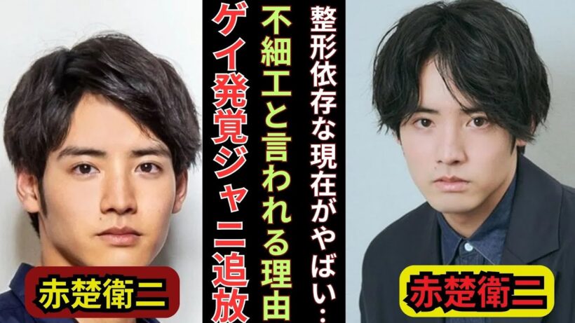 赤楚衛二、同性愛公表の真実…ジャニーズ追放の難病アイドルが不細工と言われる整形末路に絶句！