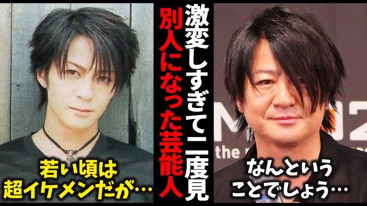 【まじか…】もはや誰かわからない…激変しすぎて二度見レベルの芸能人まとめ【ガルちゃん芸能・有益2ch】