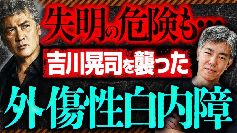 【白内障】吉川晃司さんの「眼内レンズ再固定手術」とは？外傷性白内障や失明リスクを眼科医が解説