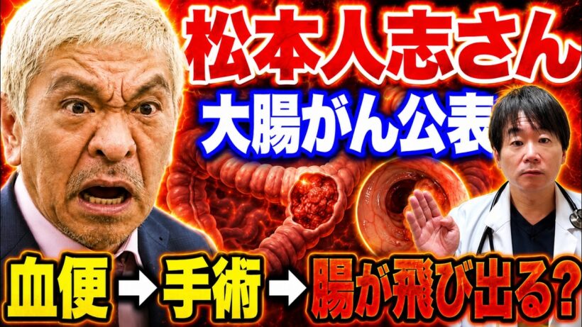 松本人志さん【腸が腹から飛び出てる】「血便が止まれへん」「俺、死ぬか思ったわ」