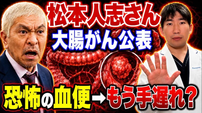 【松本人志さん大腸がん公表】血便はもう手遅れ？専門医が本当のことを解説