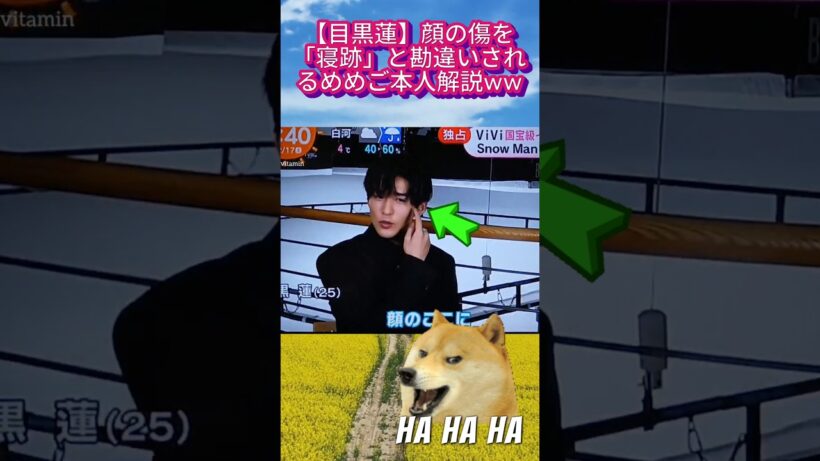 【目黒蓮】顔の傷を「寝跡」と勘違いされるめめご本人解説ww#目黒蓮 #めめ #snowman