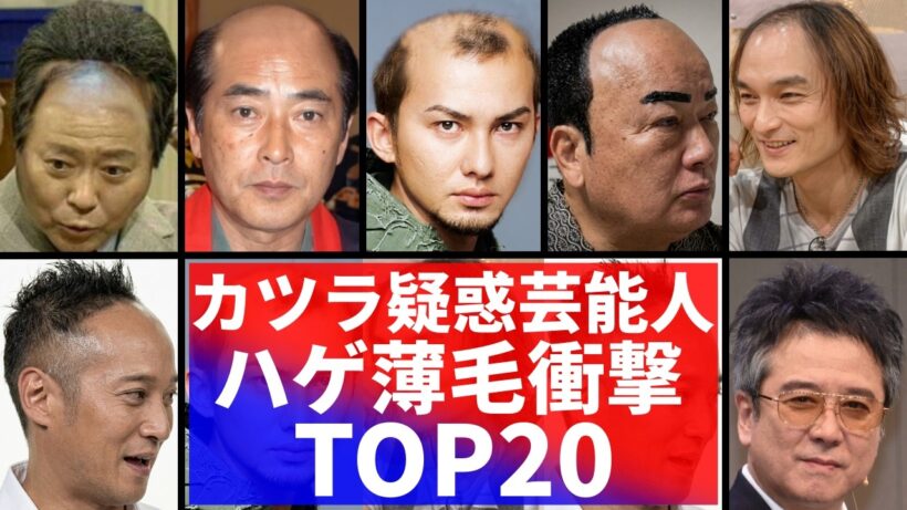 【驚愕】まさかあの人も…実はカツラを着けている芸能人20選！ハゲ疑惑の証拠画像を徹底検証