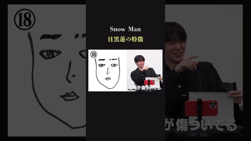 【努力】SnowMan 目黒蓮の顔にキズ　その理由は？