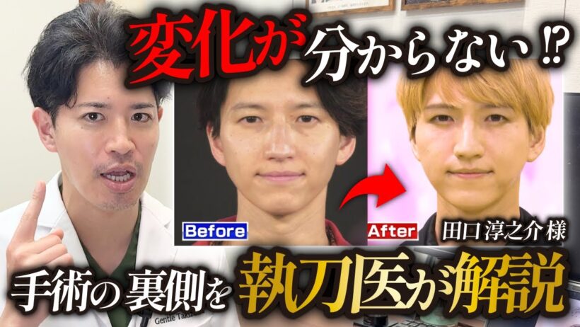 【執刀医が解説】元KAT-TUN田口淳之介さんはなぜ自然に若返った？実際に行った美容整形を全公開　@BEAUTY-STADIUM