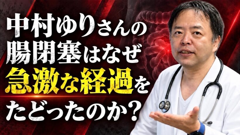 直腸がんの中村ゆりさんはなぜ腸閉塞で急逝されたのか？【専門医解説】有名人がん解説シリーズ