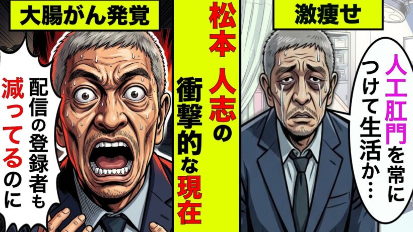 大腸がんになった松本人志のヤバ過ぎる現在！人工肛門になりマッチョが激痩せした姿に驚愕